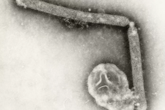 This undated electron microscopic image provided by the Centers for Disease Control and Prevention shows two Influenza A (H5N1) virions, a type of bird flu virus. (Cynthia Goldsmith, Jackie Katz/CDC via AP, File)