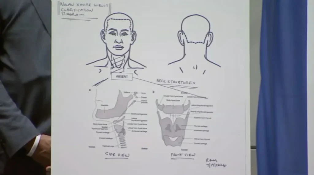 The autopsy was performed by Dr. Roger Mitchell, President of the National Medical Association.